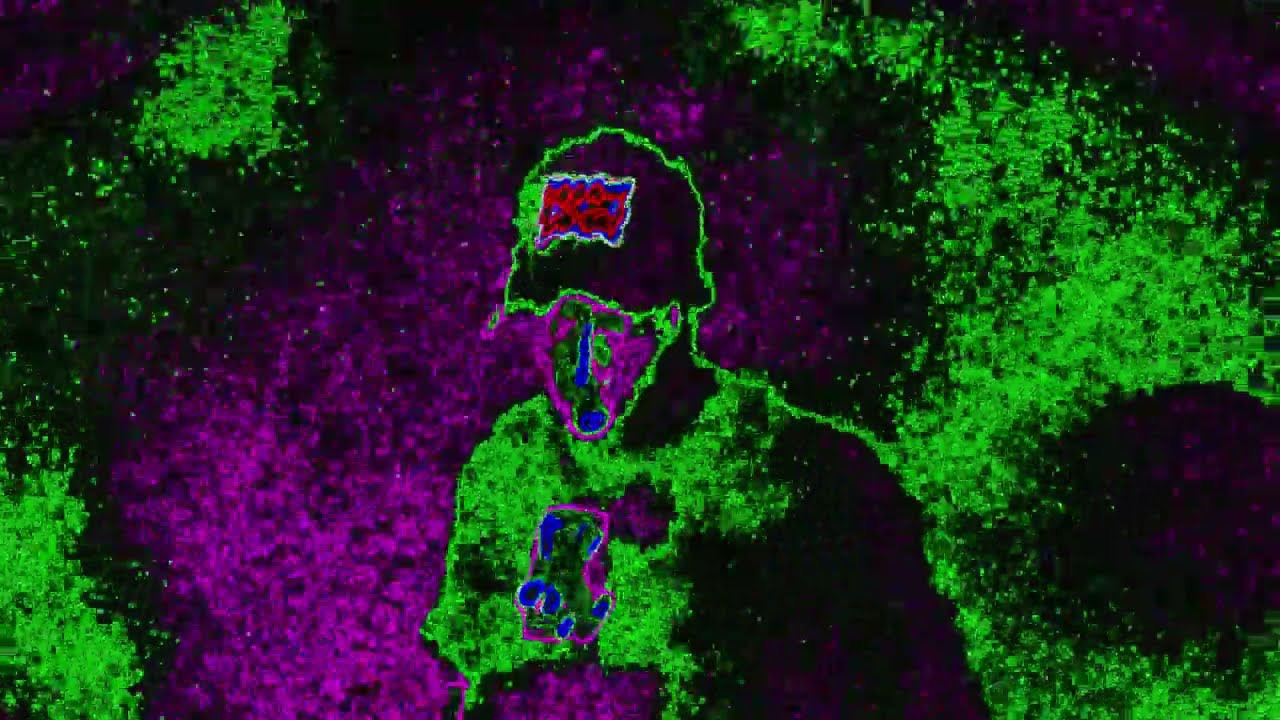 XRay-Zae - KICKSTAND - (Prod. AGDYNASTY) [Official Visualizer ]