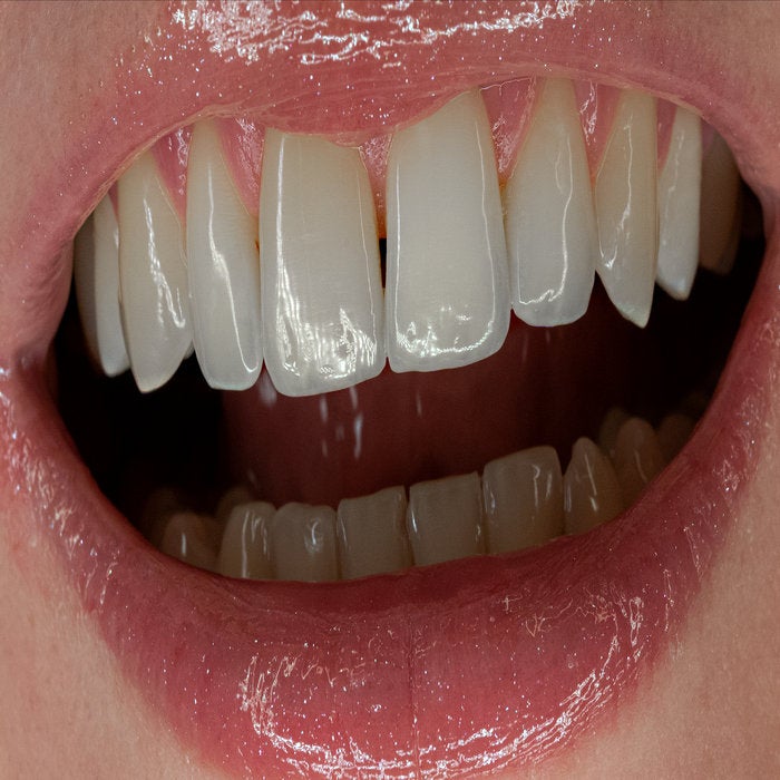 SKIN005 - Valerie Ace (Bandcamp)